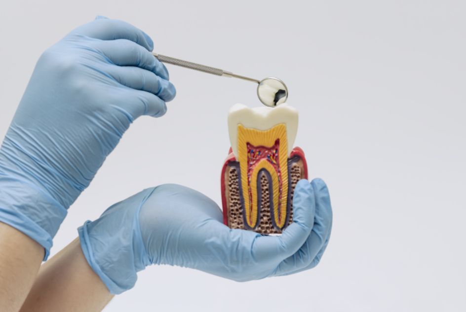 Zapalenie miazgi zęba